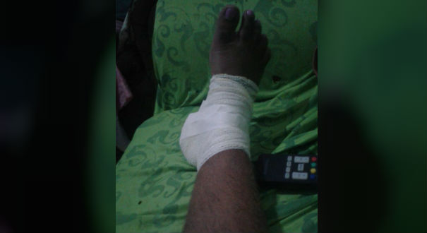Jovem ficou com a perna ferida após o atropelamento. Crédito: Arquivo Pessoal