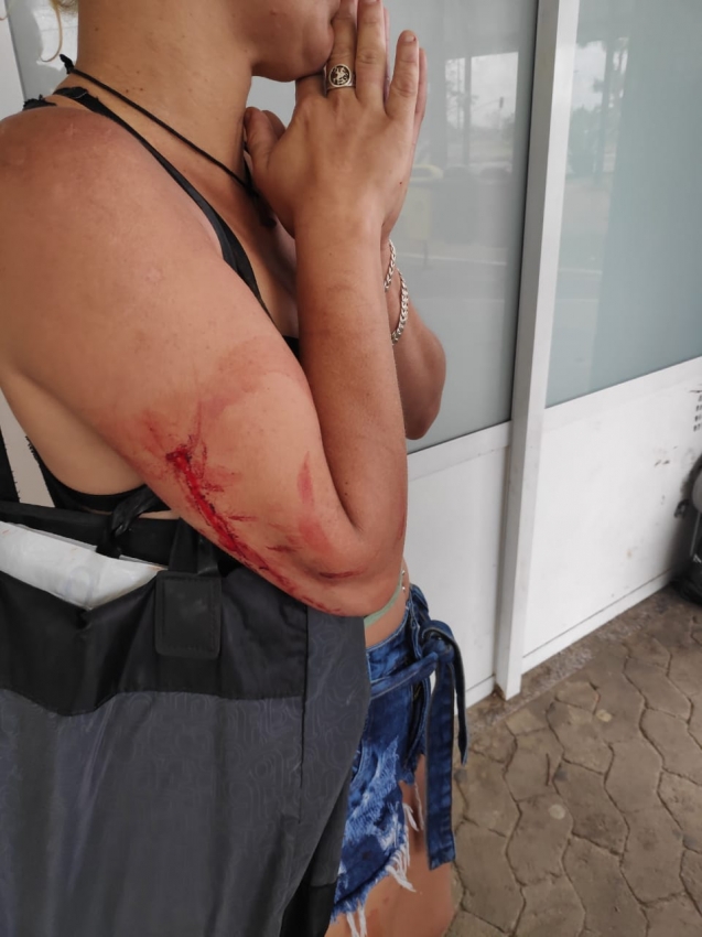 Mãe do estudante foi ferida com uma facada no braço. Crédito: Isaac Ribeiro
